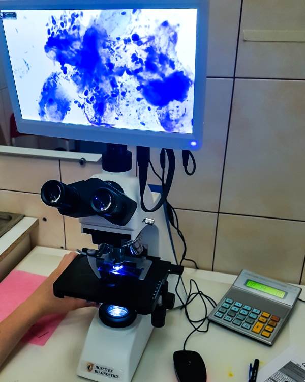 малассезии (грибок у кошек) в микроскопе