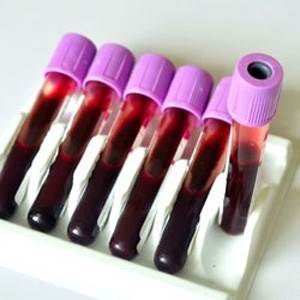 Клинический анализ крови ока крови